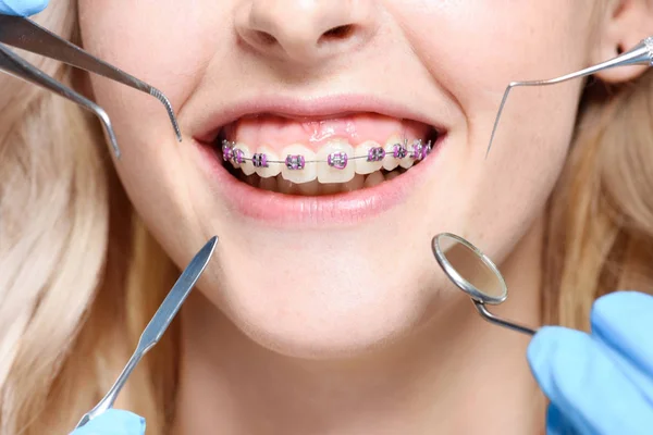 Dentist tools in front of mouth with braces — Stock Photo, Image