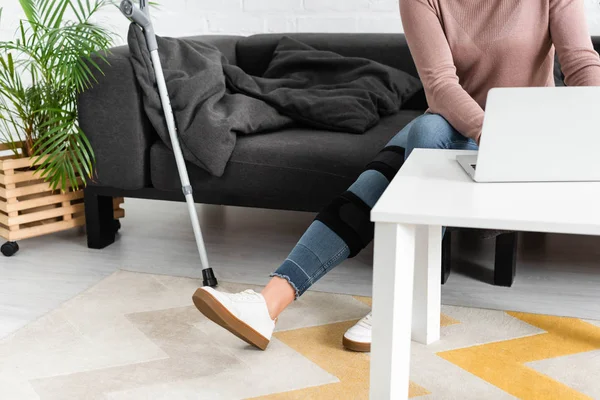 Cropped View Woman Broken Leg Having Online Consultation Doctor Laptop — Stock Photo, Image