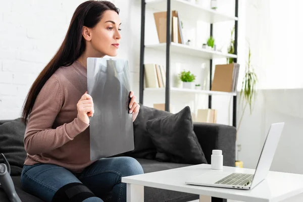 Piękna Kobieta Pokazując Rentgen Nogi Konsultacji Online Lekarzem Laptopie — Zdjęcie stockowe