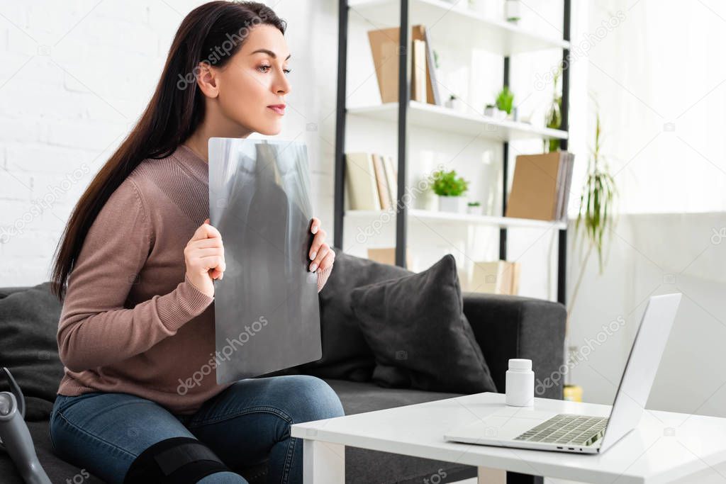 Beautiful woman showing x-ray of leg on online consultation with doctor on laptop