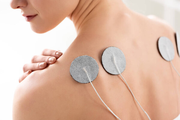Cropped view of back of young woman with electrodes during electrode treatment in clinic