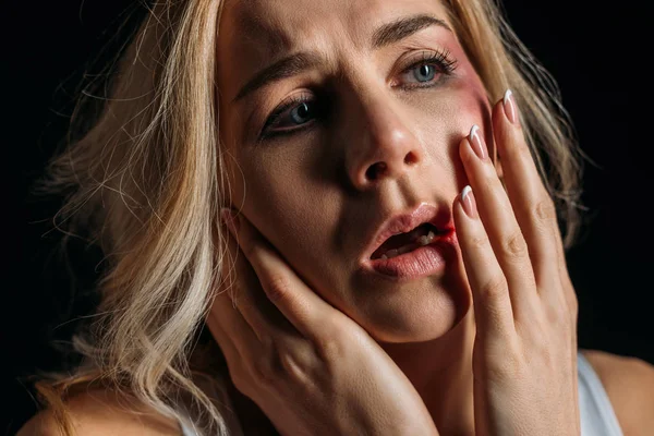 stock image Scared Victim with open mouth and bruise touching face isolated on black 