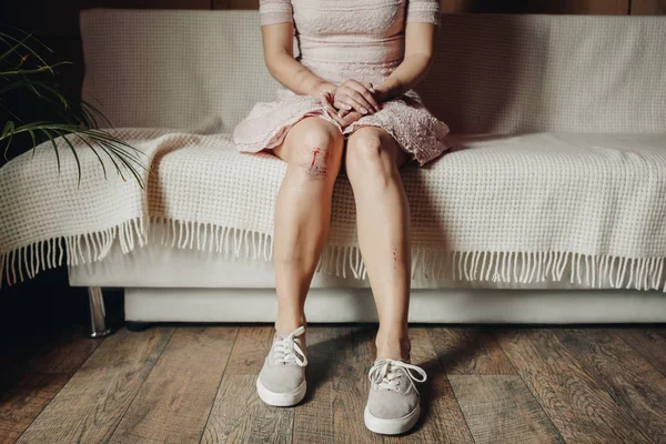 Vista Cortada Mulher Com Hematomas Ferida Sentada Sofá Casa — Fotografia de Stock