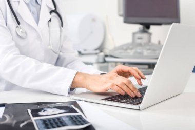 Bilgisayarda çalışan doktorun ultrason taramalarıyla çekilmiş görüntüsü. 