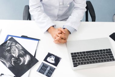 Klinikte ultrason taramaları ve dizüstü bilgisayarı olan profesyonel bir kadın doktor.