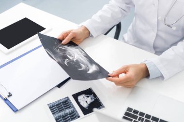 cropped view of professional doctor looking at ultrasound scan in clinic  clipart