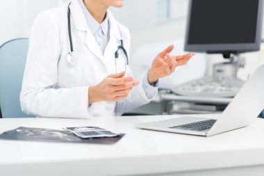 Klinikte laptopta ultrason tarayıcısıyla çalışan profesyonel bir kadın doktor.
