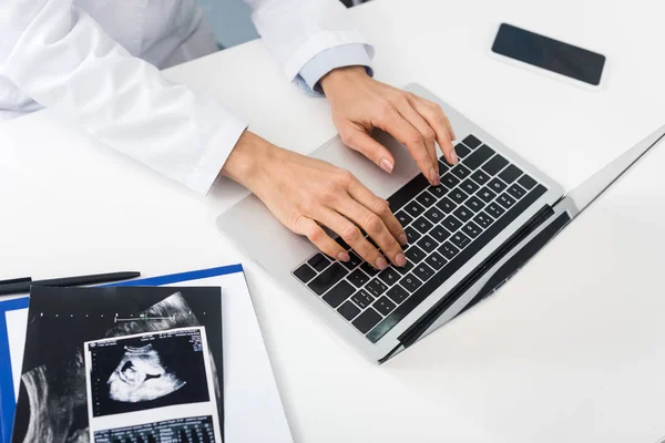 Vedere Decupată Medicului Profesionist Scanări Ultrasunete Care Lucrează Laptop Smartphone — Fotografie, imagine de stoc