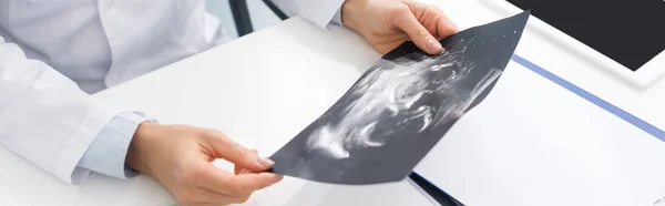 Pandangan Terpotong Dari Dokter Wanita Profesional Melihat Usg Scan Tembakan — Stok Foto