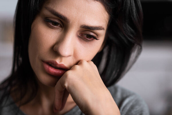 close up of injured woman with bruise touching face, domestic violence concept 