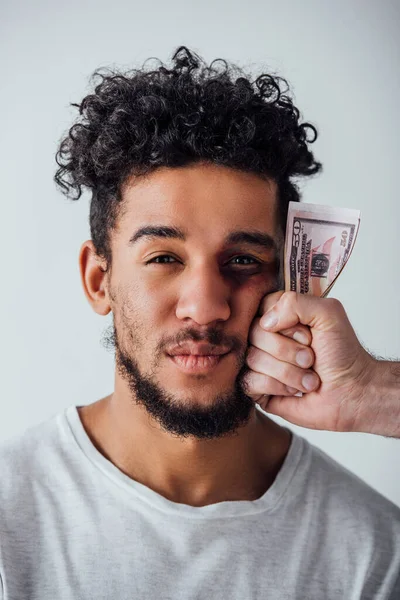 Mano Masculina Sosteniendo Dólares Cerca Cara Del Hombre Afroamericano Con —  Fotos de Stock