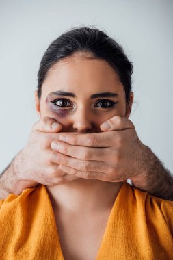 Erkek elleri, gri renkte çürükleri olan Hintli kadının ağzını kapatıyor.
