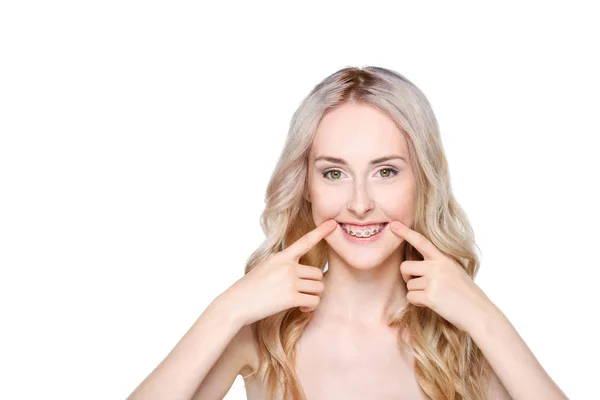 Frau zeigt auf Zähne mit Zahnspange — Stockfoto
