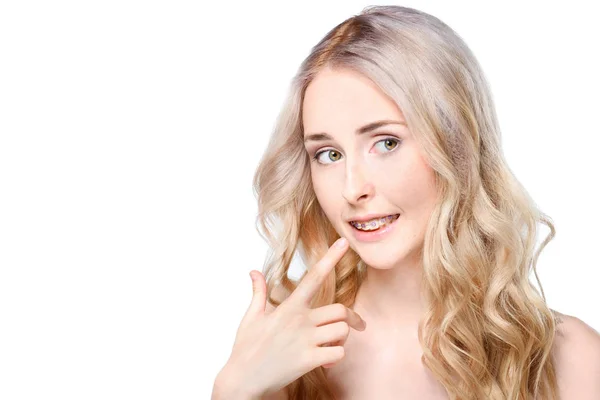 Woman pointing to teeth with braces — Stock Photo