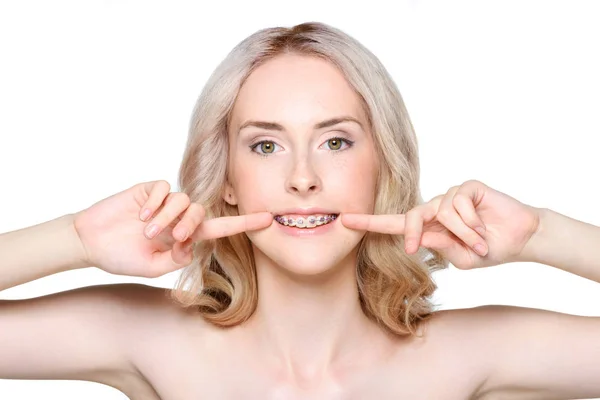 Femme pointant vers les dents avec des bretelles — Photo de stock