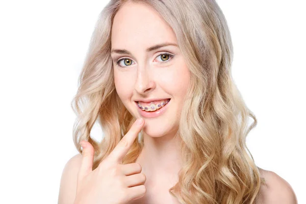 Woman pointing to teeth with braces — Stock Photo