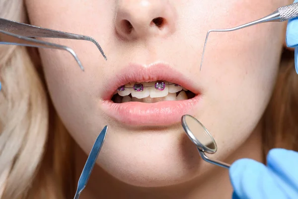 Outils de dentiste — Photo de stock