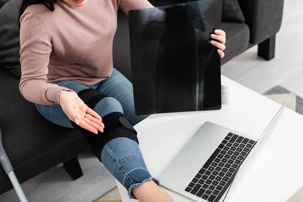 Vista cortada da mulher mostrando raio-x da perna em consulta on-line com o médico no laptop — Fotografia de Stock