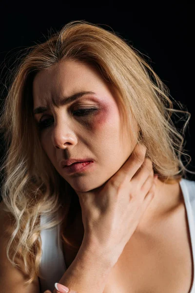 Victim with bruise touching neck isolated on black — Stock Photo