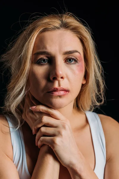 Victim with bruises touching neck and looking at camera isolated on black — Stock Photo