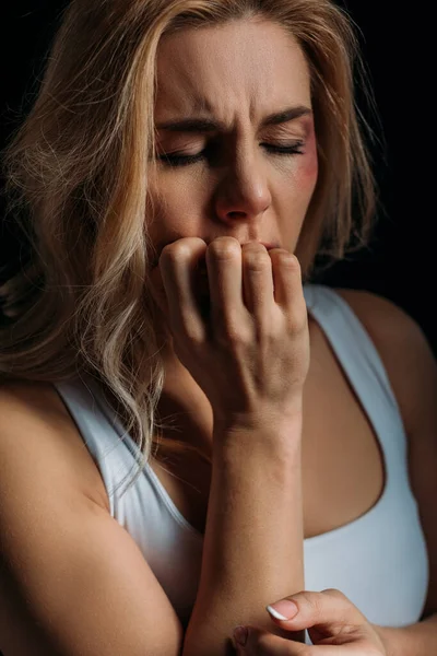 Mulher com olhos fechados e hematomas no rosto colocando a mão na boca isolada no preto — Fotografia de Stock