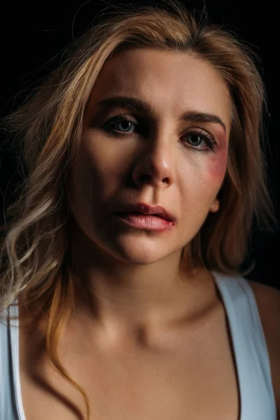Frustrated Victim with bruises on face looking at camera isolated on black — Stock Photo