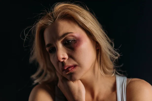 Thoughtful woman with bruises on face isolated on black — Stock Photo