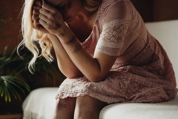 Depressed victim with lot of bruises putting head on hands, sitting on sofa at home — Stock Photo