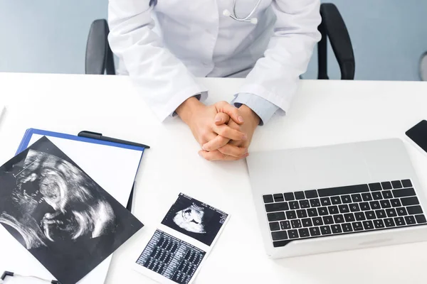 Vue recadrée du médecin professionnel féminin en clinique avec des échographies et un ordinateur portable — Photo de stock