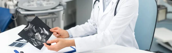 Panoramic shot of female doctor showing ultrasound scan in clinic — Stock Photo