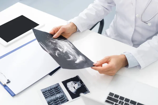 Ausgeschnittene Ansicht eines professionellen Arztes beim Ultraschallbild in der Klinik — Stockfoto