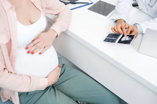 Vista recortada del médico que muestra una ecografía a una mujer embarazada joven tocando el vientre - foto de stock