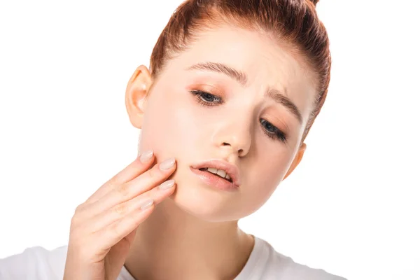 Sad female teenager with problem skin, isolated on white — Stock Photo