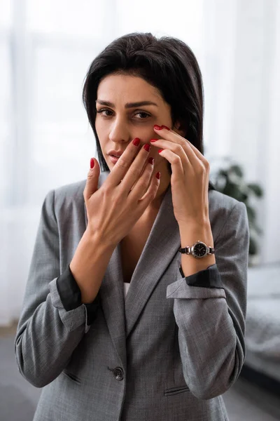 Verärgerte Geschäftsfrau berührt Gesicht mit Prellungen, häusliche Gewalt Konzept — Stockfoto