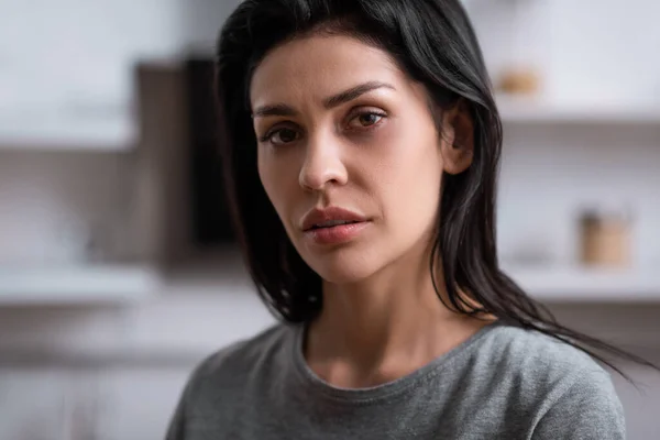 Femme bouleversée avec des ecchymoses sur le visage regardant la caméra, concept de violence domestique — Photo de stock