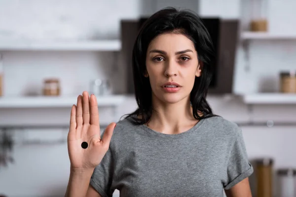 Femme bouleversée avec ecchymose sur le visage et point noir sur la paume, concept de violence domestique — Photo de stock