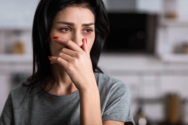 Traurige und verletzte Frau mit blauen Flecken im Gesicht, Konzept häuslicher Gewalt — Stockfoto
