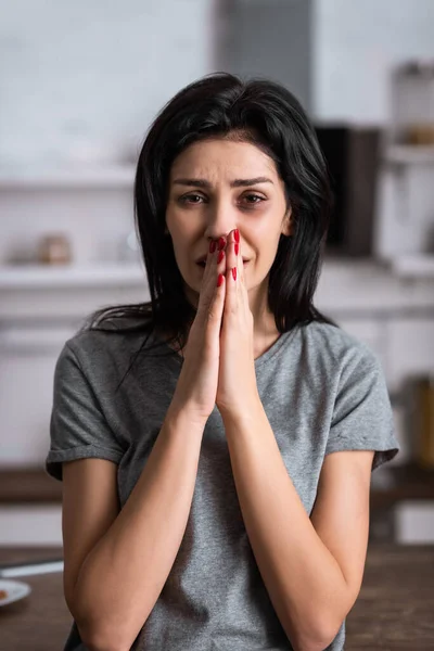 Femme blessée avec ecchymose sur le visage et les mains en prière, concept de violence familiale — Photo de stock