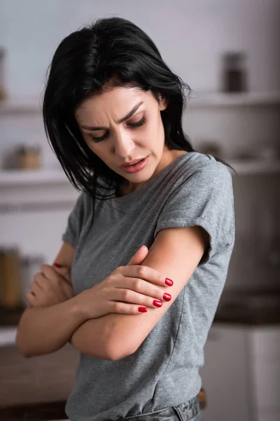 Chateado mulher tocando hematoma na mão, conceito de violência doméstica — Fotografia de Stock