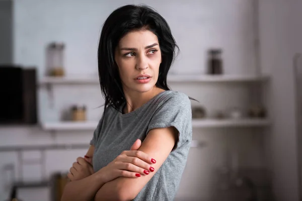 Traurige Frau, die blaue Flecken an der Hand berührt und wegsieht, Konzept häuslicher Gewalt — Stockfoto