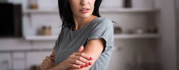 Panoramic crop of sad woman touching bruise on hand, domestic violence concept — Stock Photo