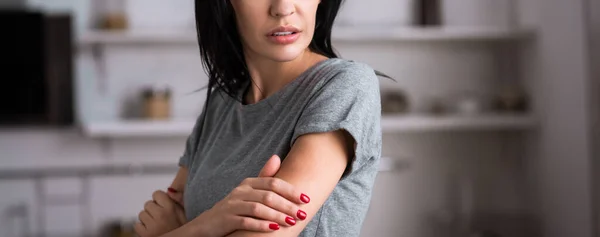 Cultivo panorámico de mujer triste tocando contusiones en la mano, concepto de violencia doméstica — Stock Photo