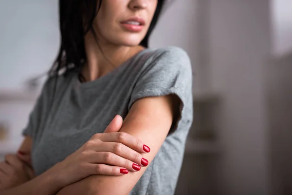 Обрезанный вид грустной женщины, касающейся синяков на руке, концепция домашнего насилия — стоковое фото