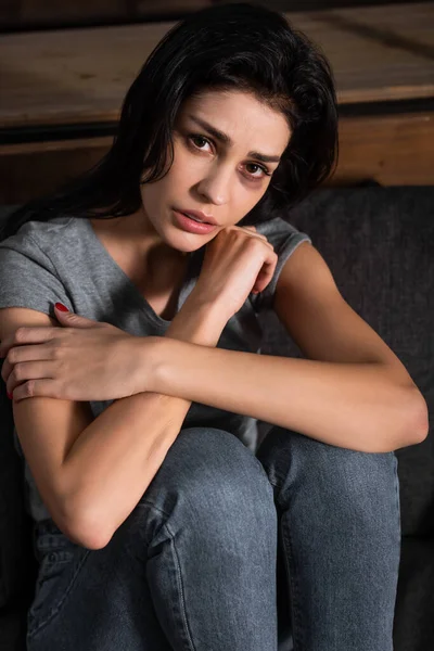 Femme frustrée avec des ecchymoses sur le visage assis sur le canapé, concept de violence domestique — Photo de stock