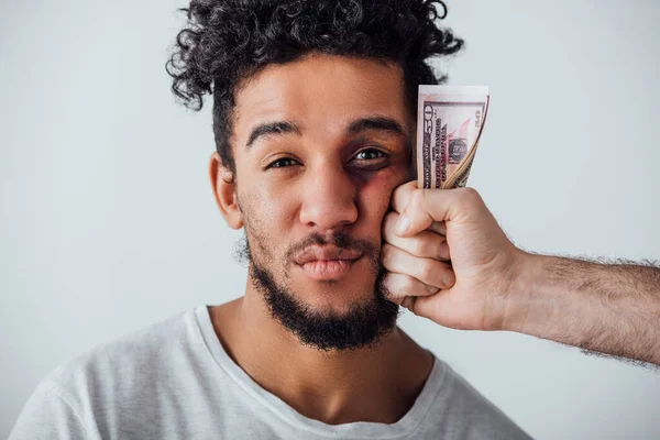 Hombre afroamericano con moretones mirando la cámara cerca de la mano masculina sosteniendo efectivo aislado en gris - foto de stock