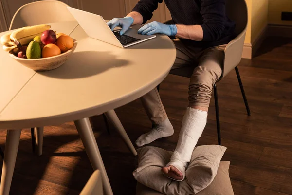 Vista recortada del hombre con vendaje de yeso en la pierna y guantes de látex utilizando el ordenador portátil en la mesa en la cocina - foto de stock