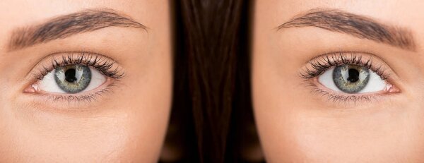 eyes of woman before and after retouch