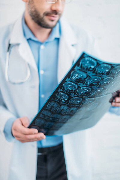 обрезанный снимок доктора, осматривающего МРТ
