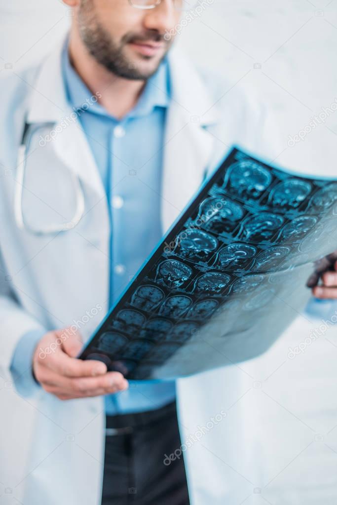 cropped shot of doctor examining mri scan