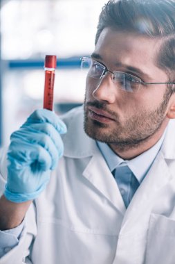 Gözlüklü yakışıklı sakallı immünolog kırmızı sıvıyla test tüpüne bakıyor. 